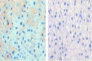 Left image is paraformaldehyde-fixed and paraffin-embedded cow lactating with CPT1A Pab (ABIN389101 and ABIN2839291) , which was peroxidase-conjugated to the secondary antibody, followed by AEC staining, right image is contrast, did not add the antibody. (CPT1A 抗体  (C-Term))