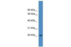 OTUB2 antibody used at 0. (OTUB2 抗体  (N-Term))