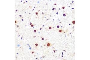 Immunohistochemistry of paraffin-embedded mouse spinal cord using KLF4 Rabbit mAb (ABIN7268157) at dilution of 1:100 (40x lens). (KLF4 抗体)