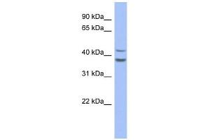 SERPINB2 antibody used at 1 ug/ml to detect target protein. (SERPINB2 抗体)