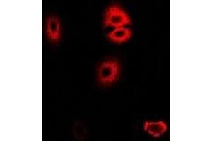 Immunofluorescence (IF) image for anti-Hydroxyacyl-Coenzyme A Dehydrogenase/3-Ketoacyl-Coenzyme A Thiolase/enoyl-Coenzyme A Hydratase (Trifunctional Protein), alpha Subunit (HADHA) antibody (ABIN7306254)