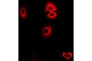 Immunofluorescent analysis of HADHA staining in U2OS cells. (HADHA 抗体)