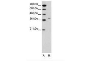 Image no. 1 for anti-Receptor-Associated Protein of The Synapse (RAPSN) (N-Term) antibody (ABIN6736649) (RAPSN 抗体  (N-Term))