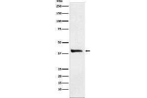 Western blot analysis of Alcohol Dehydrogenase expression in HepG2 cell lysate.