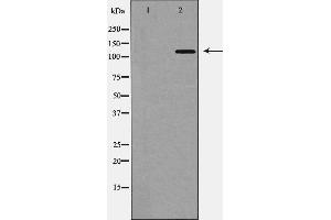 Western blot analysis of TYK2 expression in 293 cell,The lane on the left is treated with the antigen-specific peptide. (TYK2 抗体  (C-Term))