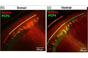 Representative images of RGS14 and PCP4 immunofluorescence. (RGS14 抗体  (AA 1-544))