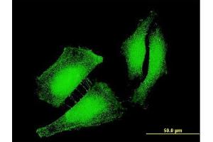 Immunofluorescence of monoclonal antibody to FOXO3 on HeLa cell. (FOXO3 抗体  (AA 361-460))