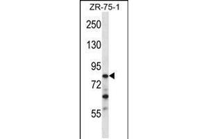 Western blot analysis in ZR-75-1 cell line lysates (35ug/lane). (CNOT3 抗体  (N-Term))
