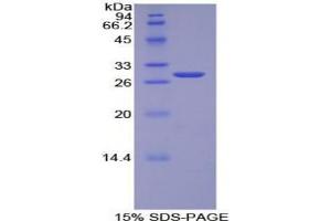SDS-PAGE analysis of Human TOR1AIP2 Protein. (TOR1AIP2 蛋白)