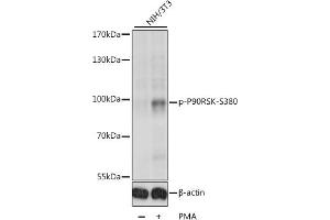 Western blot analysis of extracts of various cell lines, using Phospho-p90Rsk/RSK1/RPS6K-S380 antibody (ABIN6135275, ABIN6136172, ABIN6136173 and ABIN6225586) at 1:1000 dilution. (RPS6KA1 抗体  (pSer380))