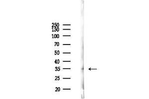 Western blot analysis of lysates from PC12 cells, using IKB beta Antibody at 1/1000 dilution.