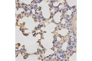 Immunohistochemistry (IHC) image for anti-Protein Kinase, CAMP Dependent, Catalytic, beta (PRKACB) antibody (ABIN1876512) (PRKACB 抗体)