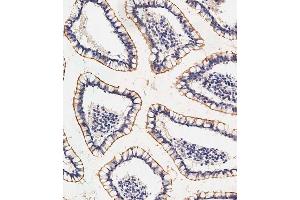 Immunohistochemistry (Paraffin-embedded Sections) (IHC (p)) image for anti-Sodium Dependent Vitamin C Transporter 1 (SVCT1) (AA 1-30), (N-Term) antibody (ABIN656646)