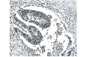 IHC analysis of NRF1 using anti-NRF1 antibody (ABIN7600874).