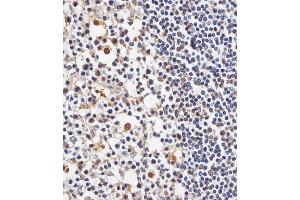 (ABIN6244013 and ABIN6578740) staining TAF4 in human tonsil tissue sections by Immunohistochemistry (IHC-P - paraformaldehyde-fixed, paraffin-embedded sections). (TAF4 抗体  (AA 1021-1062))