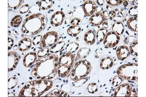 Immunohistochemical staining of paraffin-embedded Human Kidney tissue using anti-TBXAS1 mouse monoclonal antibody. (TBXAS1 抗体)