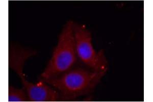 Image no. 1 for anti-Growth Associated Protein 43 (GAP43) (pSer41) antibody (ABIN401573) (GAP43 抗体  (pSer41))