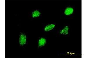 Immunofluorescence of monoclonal antibody to HEYL on HeLa cell. (HEYL 抗体  (AA 221-327))