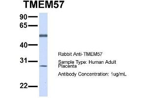 Host:  Rabbit  Target Name:  TMEM57  Sample Type:  Human Adult Placenta  Antibody Dilution:  1. (TMEM57 抗体  (N-Term))