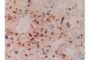 Used in DAB staining on fromalin fixed paraffin- embedded liver tissue (Azurocidin 抗体  (AA 23-247))