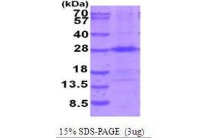 SDS-PAGE (SDS) image for THO Complex 7 (THOC7) (AA 1-204) protein (His tag) (ABIN5854049)