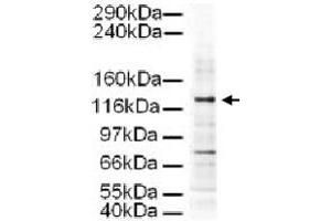 Western blot using AP3D1 polyclonal antibody  shows detection of a 130 KDa band corresponding to Human AP3D1 in a HeLa whole cell lysate. (AP3D1 抗体  (AA 686-698))