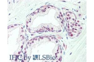Immunohistochemistry (IHC) image for anti-TAF1 RNA Polymerase II, TATA Box Binding Protein (TBP)-Associated Factor, 250kDa (TAF1) (C-Term) antibody (ABIN233826)