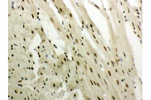 Immunohistochemistry (Paraffin-embedded Sections) (IHC (p)) image for anti-Nuclear Receptor Subfamily 3, Group C, Member 1 (Glucocorticoid Receptor) (NR3C1) (AA 20-199) antibody (ABIN3043371) (Glucocorticoid Receptor 抗体  (AA 20-199))