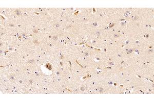 Immunohistochemistry (IHC) image for anti-Haptoglobin (HP) (AA 123-307) antibody (ABIN7432676)
