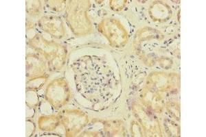 Immunohistochemistry of paraffin-embedded human kidney tissue using ABIN7170910 at dilution of 1:100 (SUCLA2 抗体  (AA 1-180))