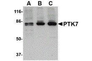 Western Blotting (WB) image for anti-PTK7 Protein tyrosine Kinase 7 (PTK7) (N-Term) antibody (ABIN2476280)