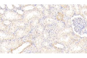 Detection of AhR in Human Kidney Tissue using Polyclonal Antibody to Aryl Hydrocarbon Receptor (AhR) (Aryl Hydrocarbon Receptor 抗体  (AA 128-399))