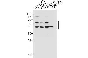 All lanes : Anti-WT1 Antibody (Center ) at 1:1000 dilution Lane 1: HT-1080 whole cell lysate Lane 2: K562 whole cell lysate Lane 3: MOLT-4 whole cell lysate Lane 4: Mouse kidney lysate Lysates/proteins at 20 μg per lane. (WT1 抗体  (AA 346-375))