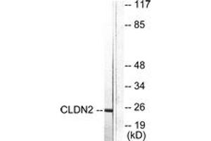 Western blot analysis of extracts from NIH-3T3 cells, using Claudin 2 Antibody. (Claudin 2 抗体  (AA 181-230))