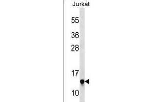RPS23 Antibody (N-term) (ABIN1538877 and ABIN2850072) western blot analysis in Jurkat cell line lysates (35 μg/lane). (RPS23 抗体  (N-Term))