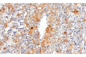 Immunohistochemistry (IHC) image for anti-Solute Carrier Family 18 (Vesicular Monoamine Transporter), Member 2 (SLC18A2) (C-Term) antibody (ABIN570915)