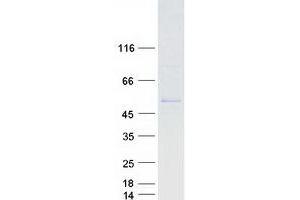 Western Blotting (WB) image for Cytochrome P450, Family 2, Subfamily A, Polypeptide 7 (CYP2A7) (Transcript Variant 1) protein (Myc-DYKDDDDK Tag) (ABIN2712761)
