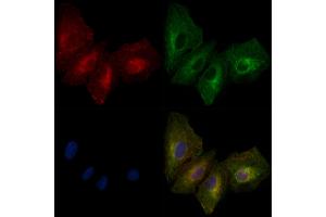 ABIN6261372 and ABIN6279351 staining  cells by IF/ICC.