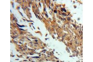 Used in DAB staining on fromalin fixed paraffin-embedded ovary tissue (TGM3 抗体  (AA 468-693))