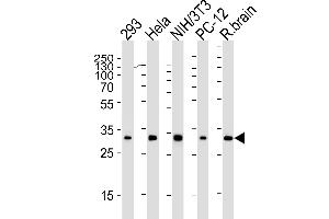 Western blot analysis of lysates from 293, Hela, mouse NIH/3T3, rat PC-12 cell line and rat brain tissue lysate(from left to right), using RPS6 Antibody (N-term) (ABIN6242615 and ABIN6577071). (RPS6 抗体)