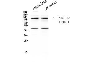 Western blot analysis of NR3C2 using anti- NR3C2 antibody . (NR3C2 抗体  (C-Term))