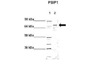 WB Suggested Anti-PSIP1 Antibody    Positive Control:  Lane 1: 5ug mouse brain cytoplasm Lane 2: 5ug mouse brain nucleus   Primary Antibody Dilution :   1:1000  Secondary Antibody :  Anti rabbit - IR-dye  Secondry Antibody Dilution :   1:10,000   Submitted by:  Anonymous