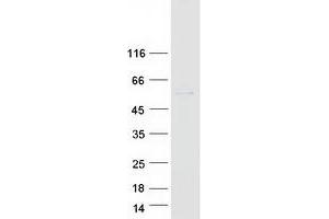 Western Blotting (WB) image for Protein Phosphatase 2, Regulatory Subunit B'', gamma (PPP2R3C) protein (Myc-DYKDDDDK Tag) (ABIN2729489)