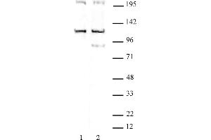 TRIM37 antibody (pAb) tested by Western blot. (TRIM37 抗体  (C-Term))