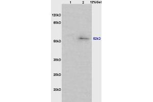 Lane 1: mouse intestine lysates Lane 2: mouse lung lysates probed with Anti phospho-MAPKAPK5(Ser93) Polyclonal Antibody, Unconjugated (ABIN710561) at 1:200 in 4 °C. (MAPKAP Kinase 5 抗体  (pSer93))
