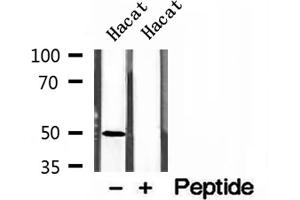 Western Blotting (WB) image for anti-Adaptor-Related Protein Complex 1, mu 1 Subunit (AP1M1) (Internal Region) antibody (ABIN6259962)