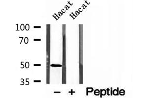 Western blot analysis of extracts of Hacat cells, using AP1M1 antibody. (AP1M1 抗体  (Internal Region))