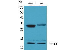 Western Blotting (WB) image for anti-Tissue Factor Pathway Inhibitor 2 (TFPI2) (C-Term) antibody (ABIN3178190) (TFPI2 抗体  (C-Term))