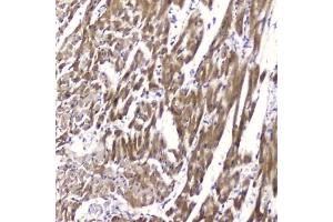 IHC testing of FFPE rat heart tissue with FABP3 antibody at 2ug/ml.