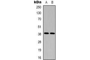 Western blot analysis of EDG5 expression in Hela (A), A10 (B) whole cell lysates. (S1PR2 抗体  (C-Term))
